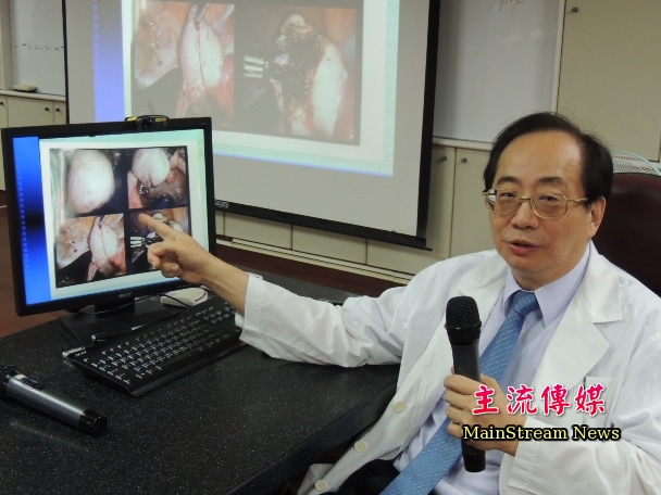 台南醫院婦產科主任蔡永隆提醒女性，生理期前勿做激烈運動。(記者吳敏慈攝)
