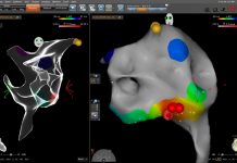 4歲就「心律不整」常掛急診!安南醫院兒童心臟科完成首例電燒手術