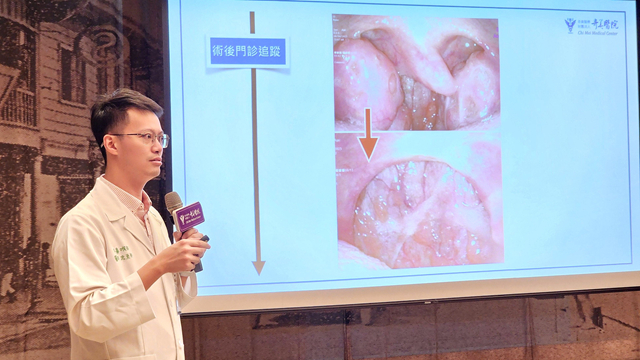 奇美醫院耳鼻喉部主治醫師沈至軒表示，針對打鼾症狀，應先安排睡眠檢測與內視鏡檢查確認原因。